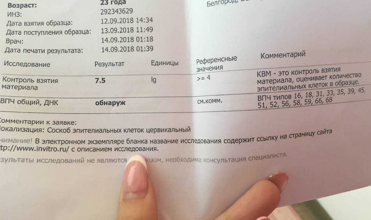 Lsass exe что это за процесс